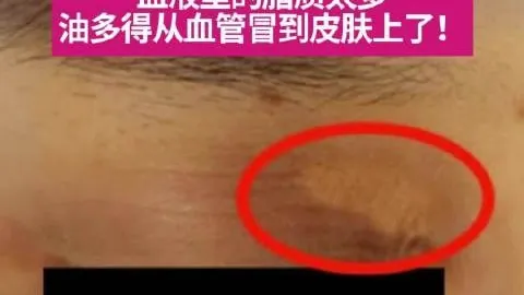 推荐 足球攻略周日021意甲赛事分析：尤文图斯对决米兰2026前瞻避雷指南